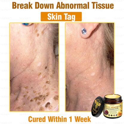 VLSVLS™ Bee Venom Comprehensive Cream 🌸🌸(Suitable for all ages & TGA recommends)